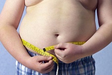Obesidad