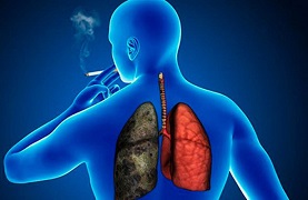 Día Mundial del EPOC: más del 80% de los pacientes son fumadores o ex fumadores