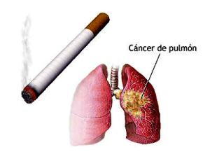 Roche se pone a la cabeza de los tratamientos para el cáncer de pulmón